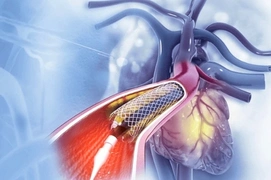 coronary-artery-bypass-surgery-cabg-delhi