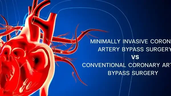 minimally-invasive-vs-conventional-bypass-surgery.jpg